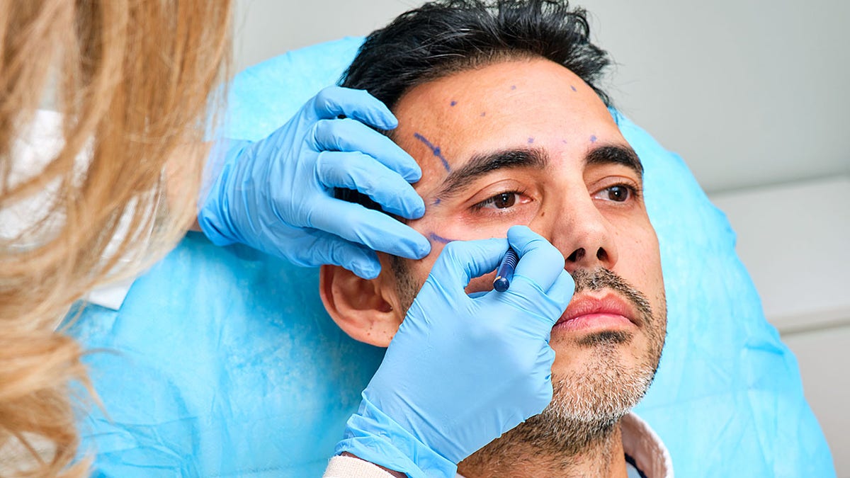 Painting the face of a 45 -year -old man for an aesthetic treatment with botulinum toxin